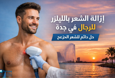 azalat-alshaar-billayzer-lilrijal-jeddah azalat-alshaar-billayzer-lilrijal-jeddah