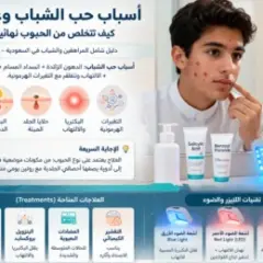 أسباب حب الشباب وعلاجه: كيف تتخلص من الحبوب نهائيًا