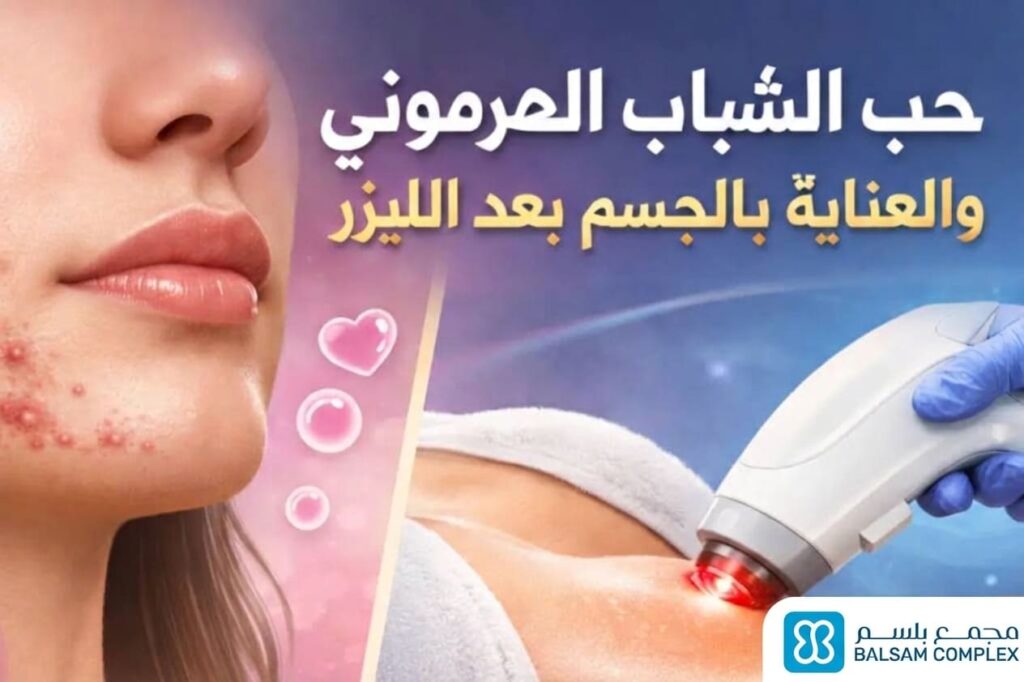 حب الشباب الهرموني و العناية بالجسم بعد الليزر