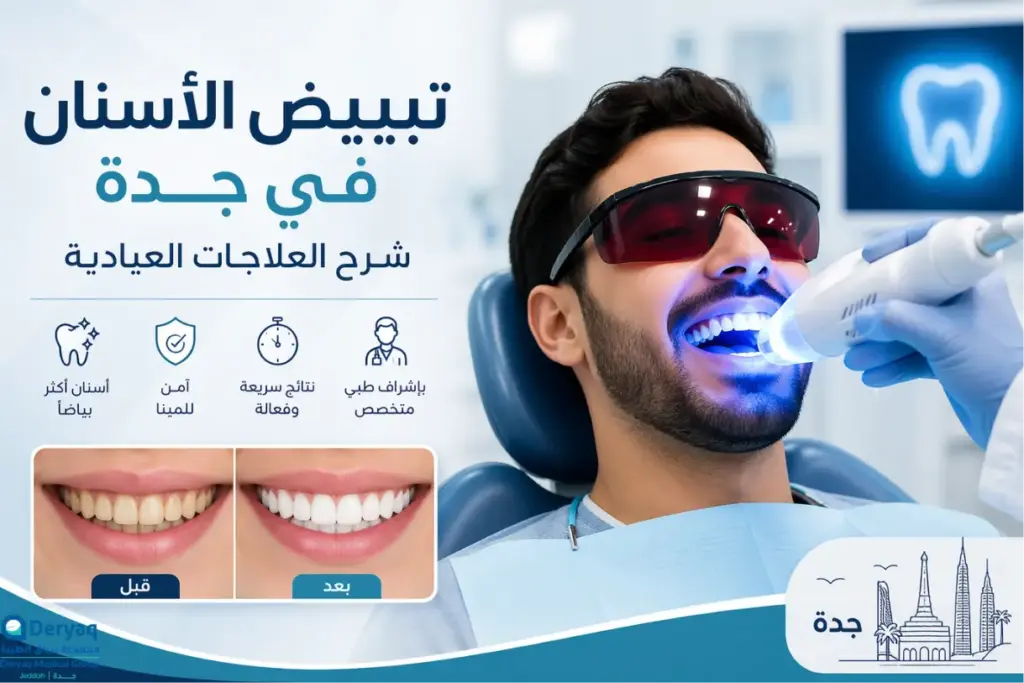 تبييض الأسنان في جدة: شرح العلاجات العيادية