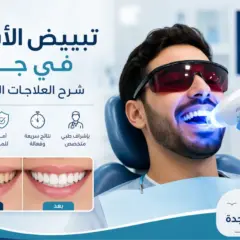 تبييض الأسنان في جدة: شرح العلاجات العيادية