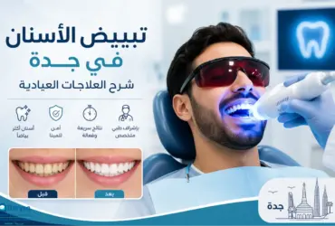 تبييض-الأسنان-في-جدة-شرح-العلاجات-العي تبييض الأسنان في جدة: شرح العلاجات العيادية