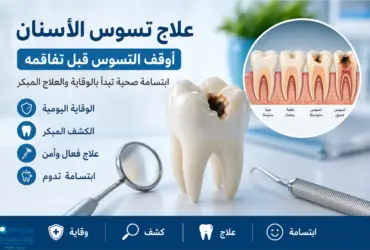 علاج-تسوس-الأسنان-مبكراً-احمِ-ابتسامت علاج تسوس الأسنان مبكراً: احمِ ابتسامتك