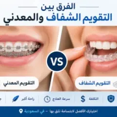 الفرق بين التقويم الشفاف والمعدني | أيهما أفضل؟