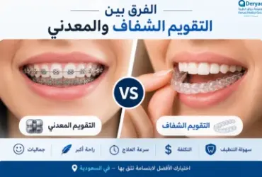 الفرق بين التقويم الشفاف والمعدني | أيهما أفضل؟ الفرق بين التقويم الشفاف والمعدني | أيهما أفضل؟