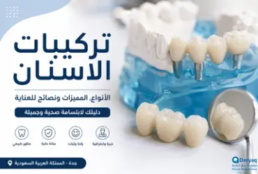 تركيبات-الاسنان-في-جدة تركيبات الاسنان في جدة مع عرض أنواع التركيبات السنية الحديثة والزيركون لتحسين الابتسامة وصحة الأسنان