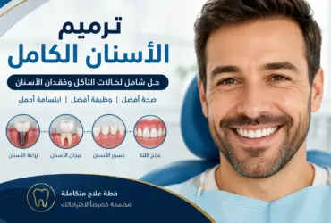 ترميم-الأسنان-الكامل-استعادة-الابتسا ترميم-الأسنان-الكامل-استعادة-الابتسا