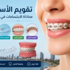 تقويم الأسنان في جدة | الفارابي لطب وتقويم الأسنان