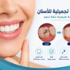 حشوات أسنان تجميلية في جدة لمظهر طبيعي
