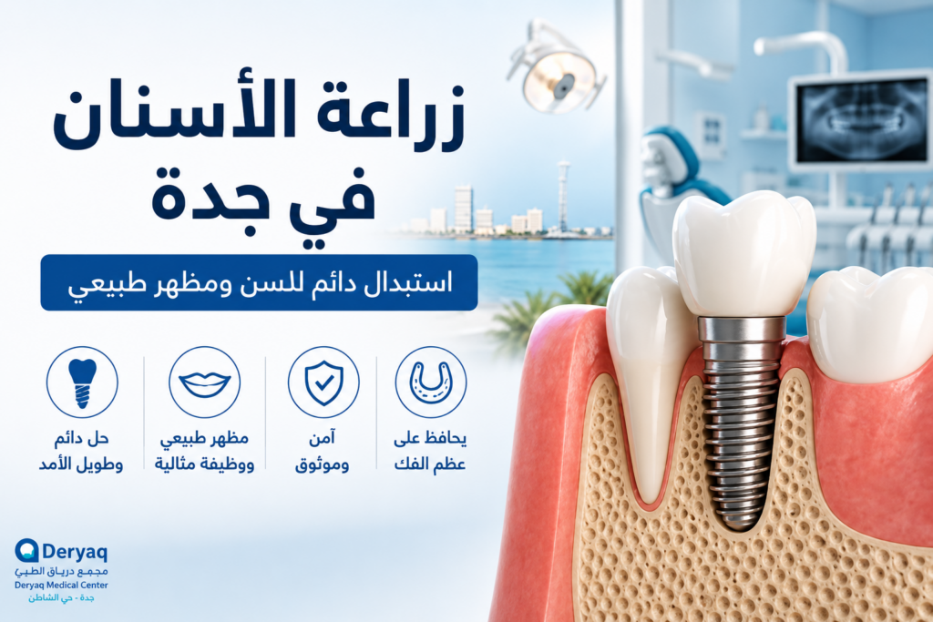 زراعة الأسنان في جدة: حل دائم لاستعادة ابتسامتك
