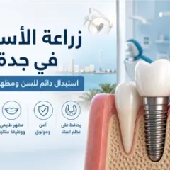 زراعة الأسنان في جدة: حل دائم لاستعادة ابتسامتك