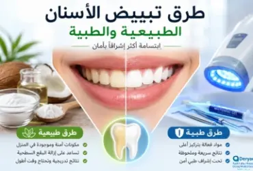 طرق-تبييض-الأسنان-الطبيعية-والطبية-بأمان طرق-تبييض-الأسنان-الطبيعية-والطبية-بأمان