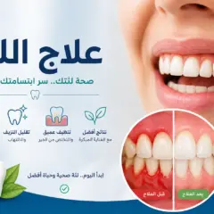 علاج اللثة: الأسباب والعلاج المبكر