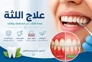 علاج-اللثة-الأسباب-والعلاج-المبكر علاج-اللثة-الأسباب-والعلاج-المبكر