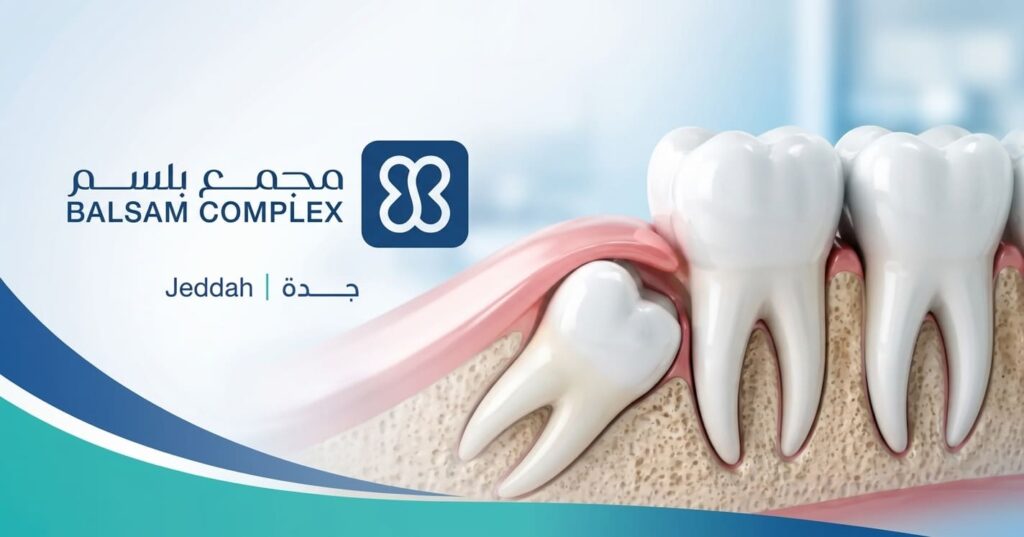 ضرس العقل: متى يحتاج إلى الخلع؟ الأعراض والتعافي